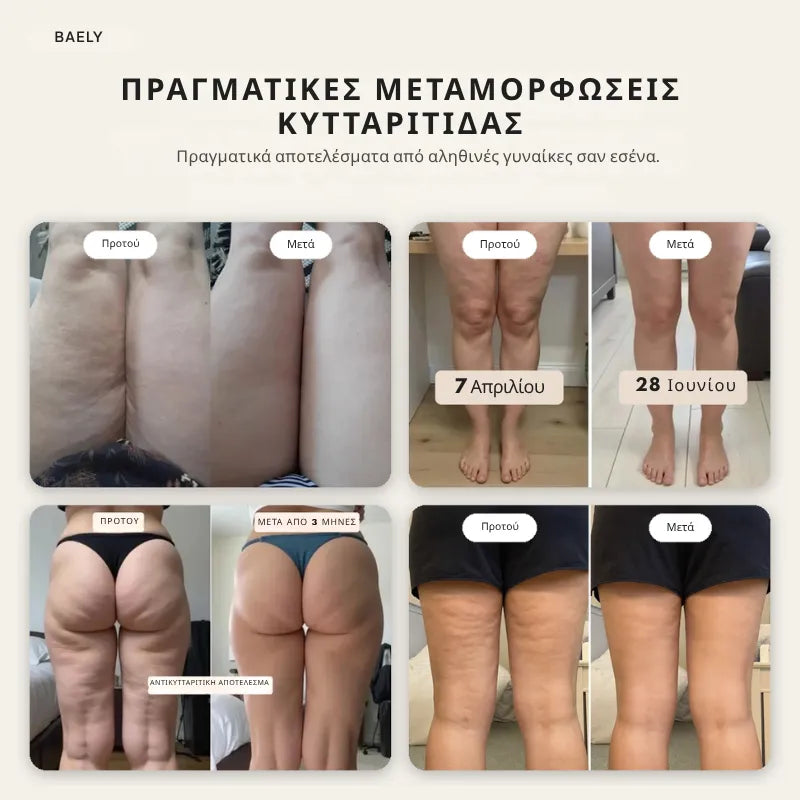 Κολάν 3D κατά της κυτταρίτιδας, για λεία επιδερμίδα και ελαφριά πόδια