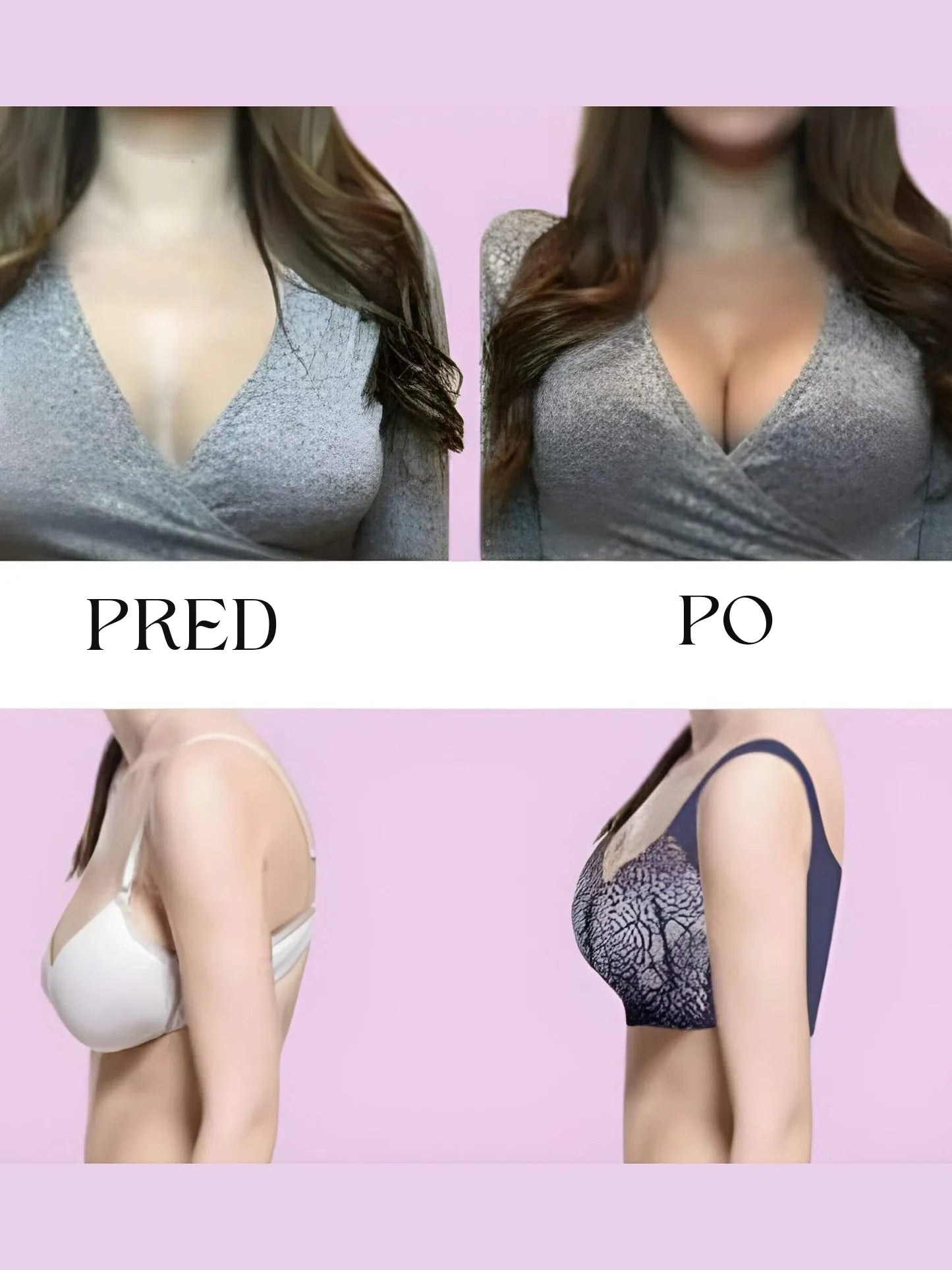 Nina – Pohodlná Push-Up Bezdrôtová Podprsenka SK